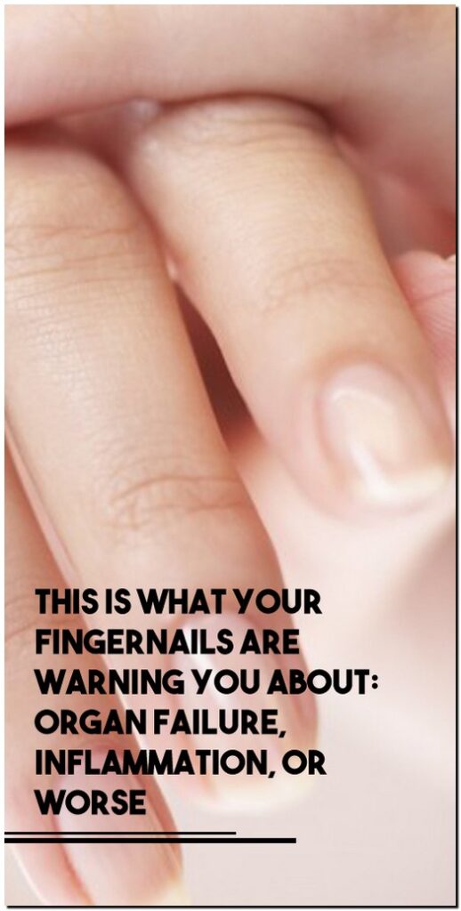 This Is What Your Fingernails Are Warning You About Organ Failure